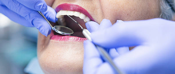 Best Emergency Dentist for Lost Fillings or Crowns in Coldspring, TX